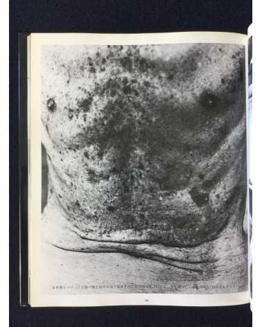 Kenji Higuchi - Photo Document Island of Poison Gas - 1983