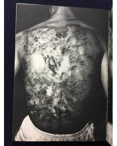 Japan Realism Photographers Association - The testimony of Nagasaki - 1970