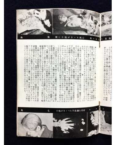Sadao Tanabe - Challenge to humanity, Atomic Bomb Damage Photographs - 1954